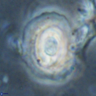 Reticulofenestra subrotunda 27081