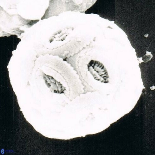 Reticulofenestra simillimus 1473 2