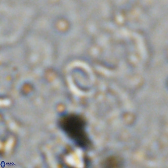 Reticulofenestra simillimus VR 10736