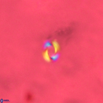 Reticulofenestra similumus VR 02141