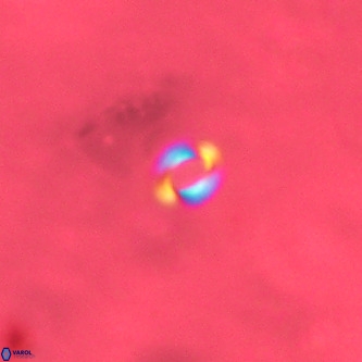 Reticulofenestra similumus VR 02145