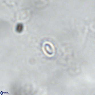 Reticulofenestra similumus VR 02148