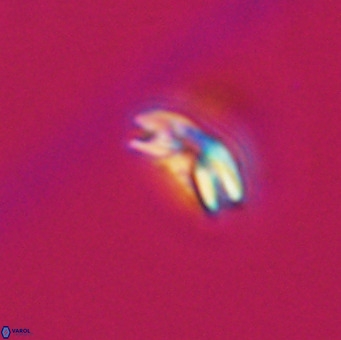 Reticulofenestra sp 1 VR 33507