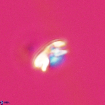 Reticulofenestra sp 1 VR 33510