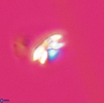 Reticulofenestra sp 1 VR 33511