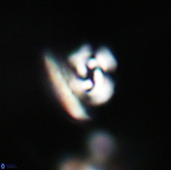 Reticulofenestra sp 1 VR 33517