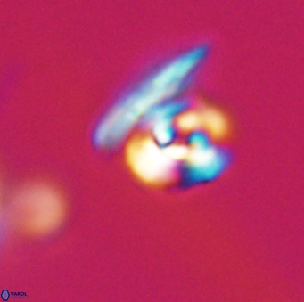Reticulofenestra sp 1 VR 33520