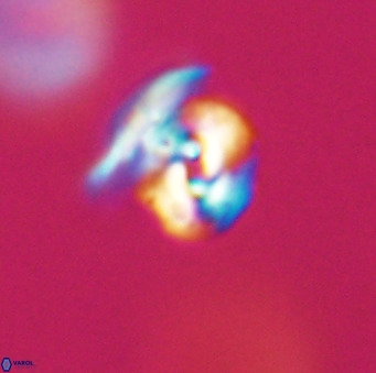 Reticulofenestra sp 1 VR 33522