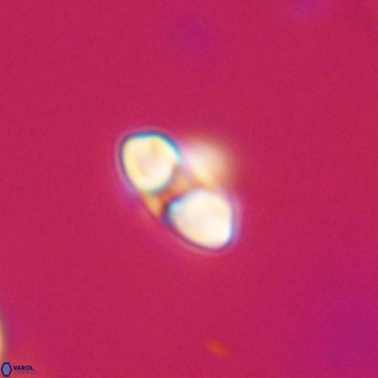 Reticulofenestra sp 2 VR 30242