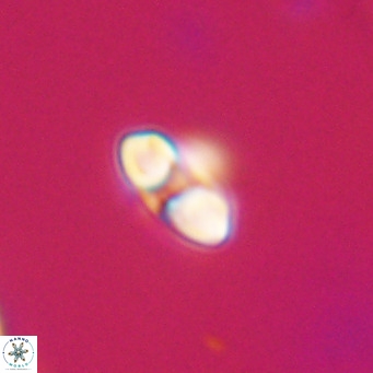 Reticulofenestra sp 2 VR 30242