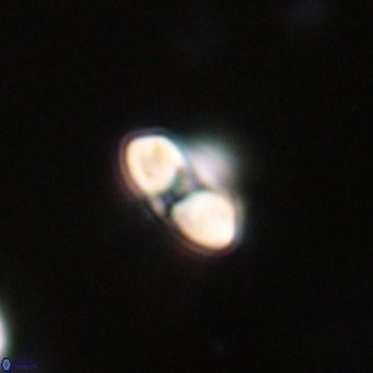 Reticulofenestra sp 2 VR 30243