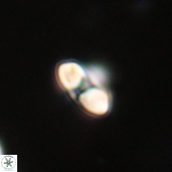 Reticulofenestra sp 2 VR 30243