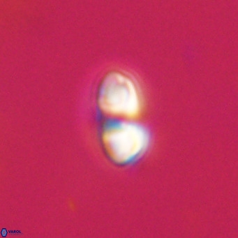 Reticulofenestra sp 2 VR 30245