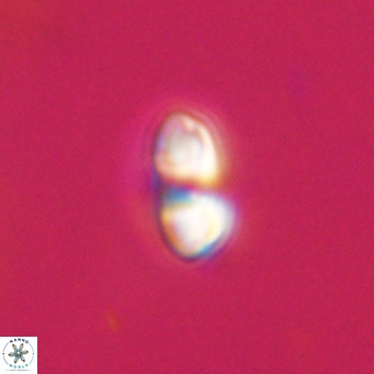 Reticulofenestra sp 2 VR 30245