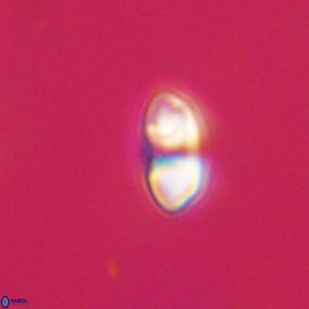 Reticulofenestra sp 2 VR 30247