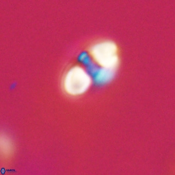 Reticulofenestra sp 2 VR 30251