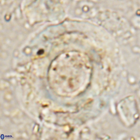 Reticulofenestra umbilicus VR 024361