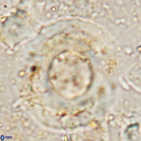 Reticulofenestra umbilicus VR 024362