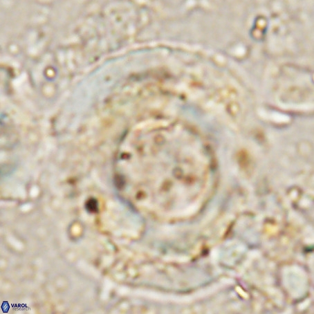 Reticulofenestra umbilicus VR 024363