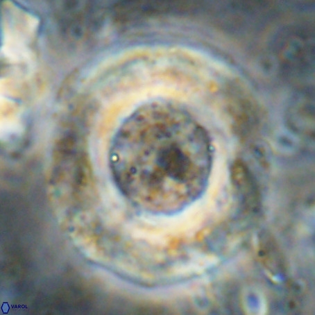 Reticulofenestra umbilicus VR 024367