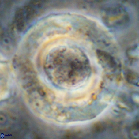 Reticulofenestra umbilicus VR 024368