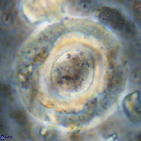 Reticulofenestra umbilicus VR 024369