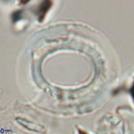 Reticulofenestra umbilicus VR 026244