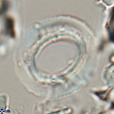 Reticulofenestra umbilicus VR 026246