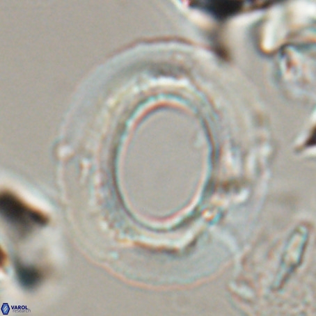 Reticulofenestra umbilicus VR 026247