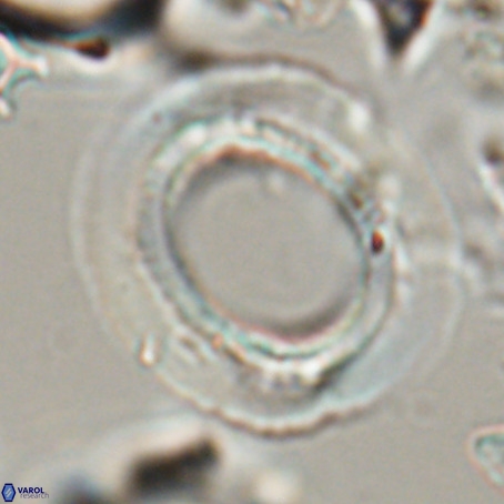 Reticulofenestra umbilicus VR 026248