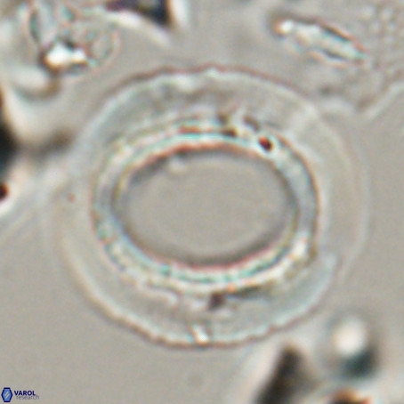 Reticulofenestra umbilicus VR 026249