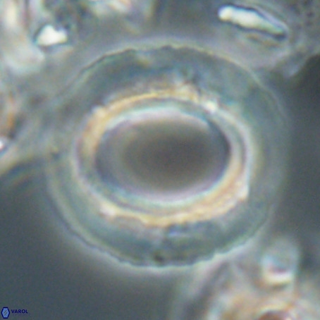 Reticulofenestra umbilicus VR 026250