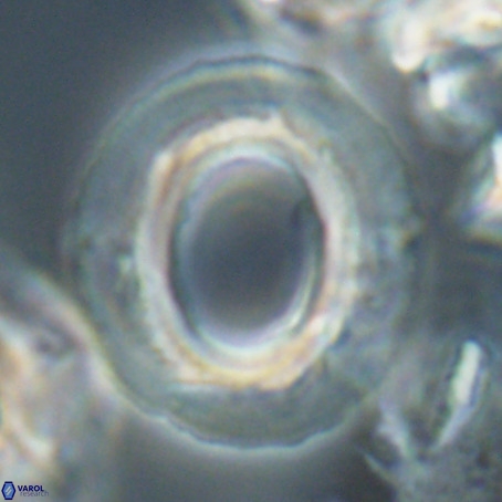 Reticulofenestra umbilicus VR 026252