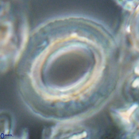 Reticulofenestra umbilicus VR 026253