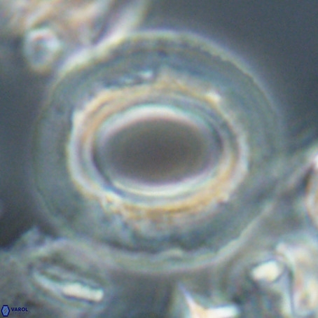 Reticulofenestra umbilicus VR 026254