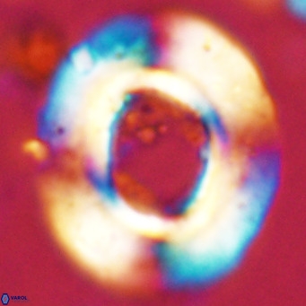 Reticulofenestra umbilicus VR 24271