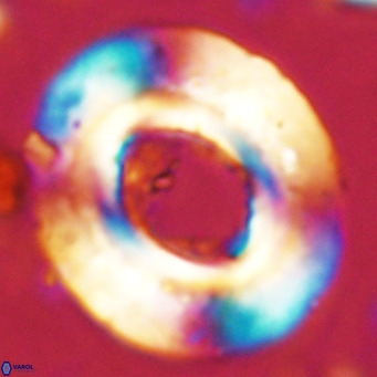 Reticulofenestra umbilicus VR 24272
