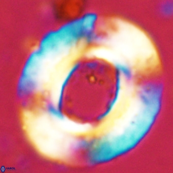 Reticulofenestra umbilicus VR 24276