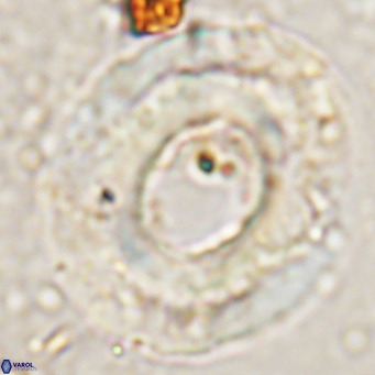 Reticulofenestra umbilicus VR 24277