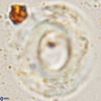 Reticulofenestra umbilicus VR 24278