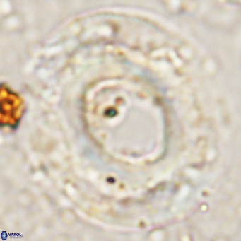 Reticulofenestra umbilicus VR 24280
