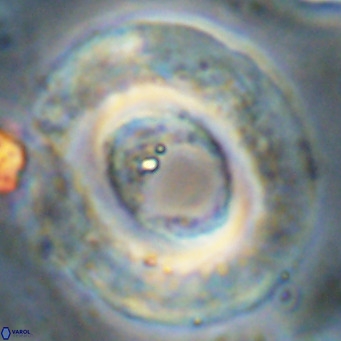 Reticulofenestra umbilicus VR 24281
