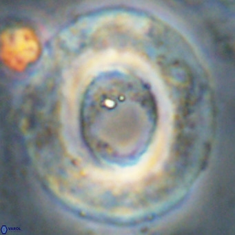 Reticulofenestra umbilicus VR 24282