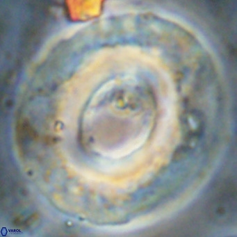 Reticulofenestra umbilicus VR 24283