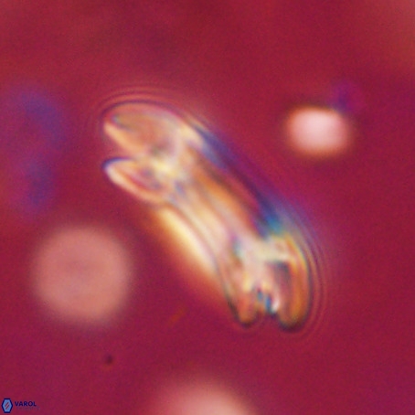 Reticulofenestra umbilicus VR 33942