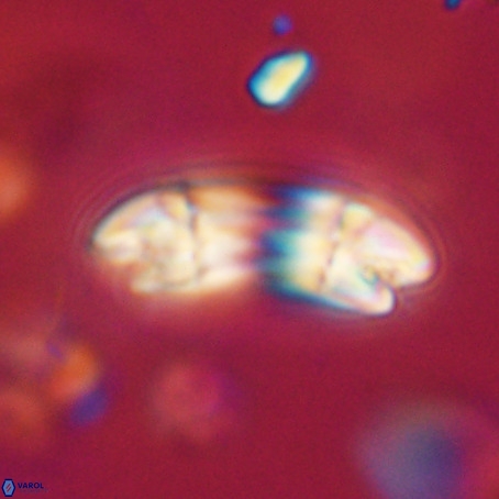 Reticulofenestra umbilicus VR 33943
