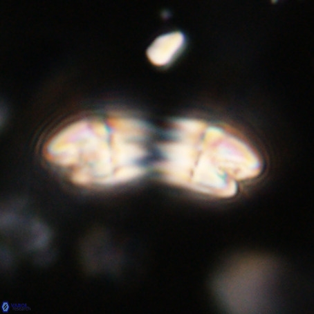 Reticulofenestra umbilicus VR 33944