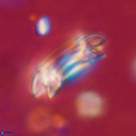 Reticulofenestra umbilicus VR 33946