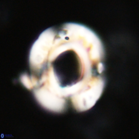 Reticulofenestra umbilicus VR 33948