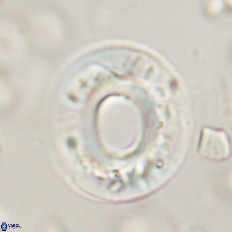 Reticulofenestra umbilicus VR 33929